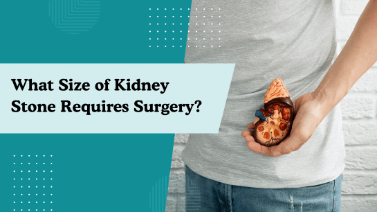 What Size of Kidney Stone Requires Surgery