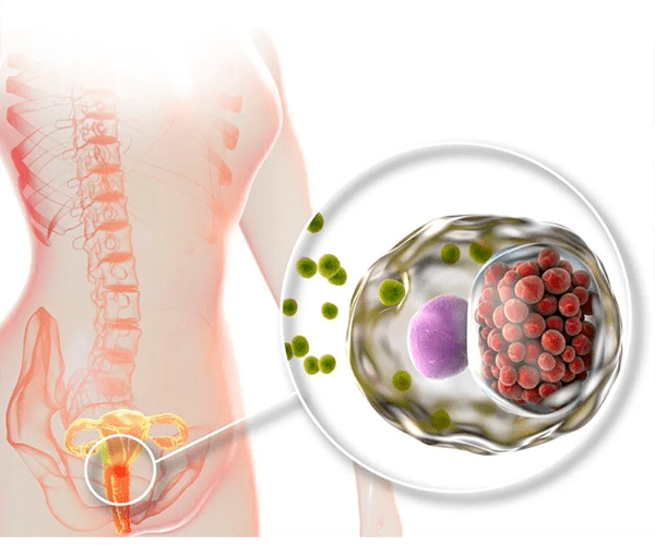 Sexually Transmitted Diseases