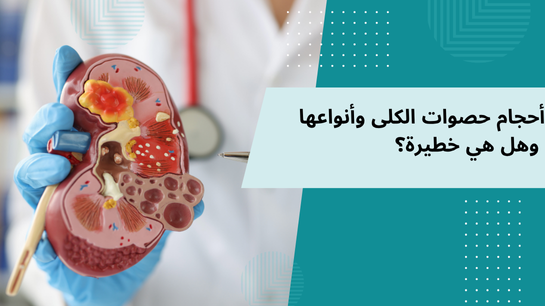 حصوات الكلى انواعها