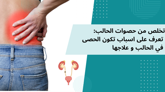حصوات الحالب - الأحجام - الأسباب - الوقاية - العلاج