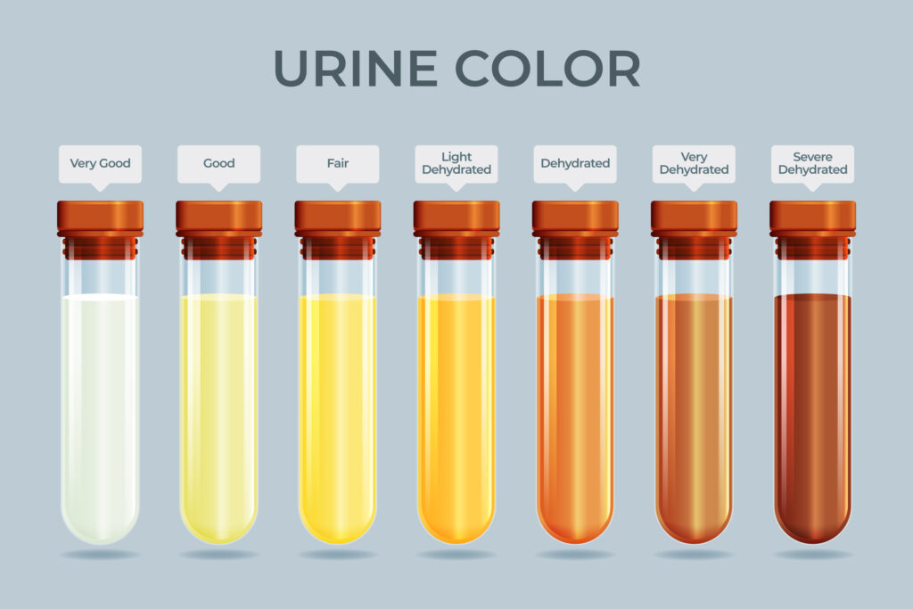 Urine colors