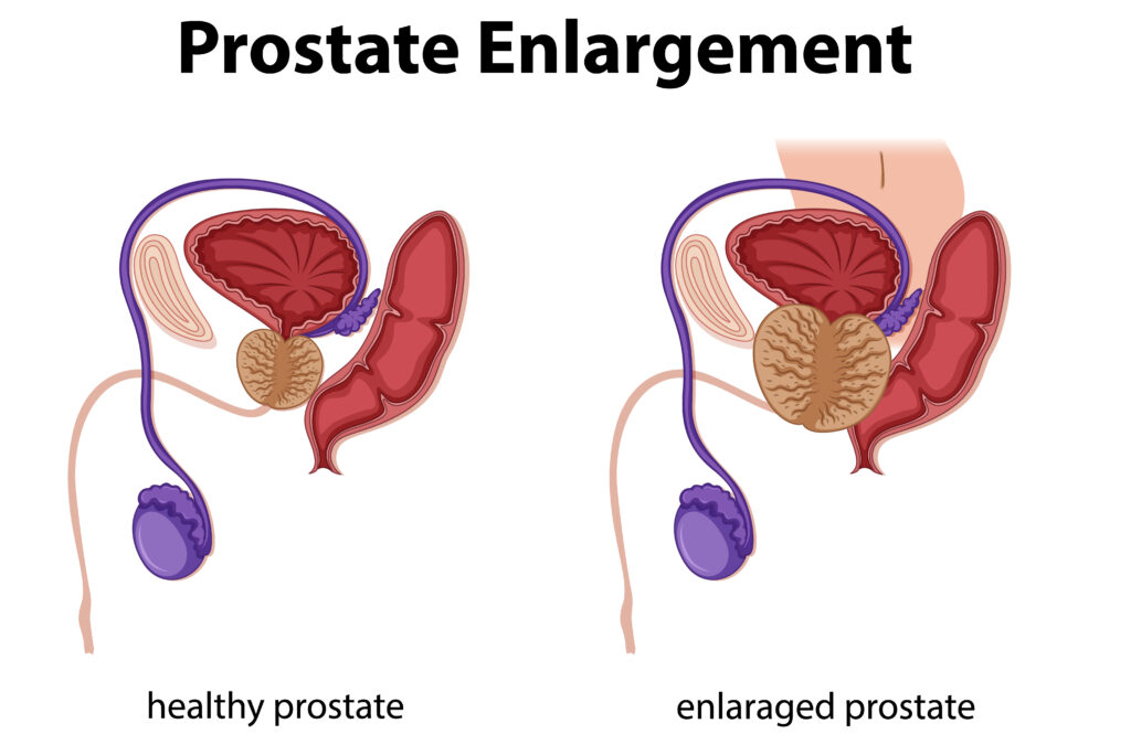 Inside the male reproductive system
