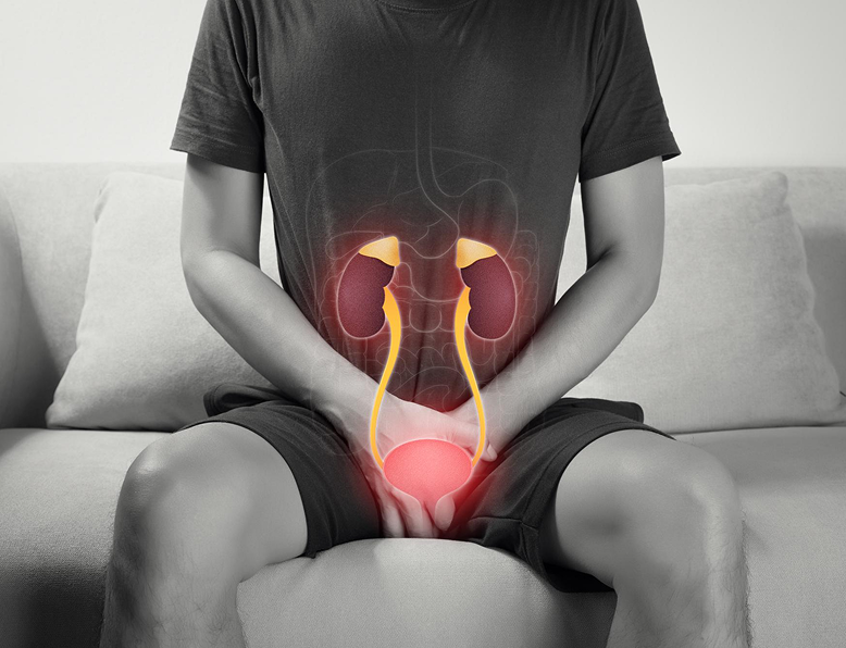 Urology conditions